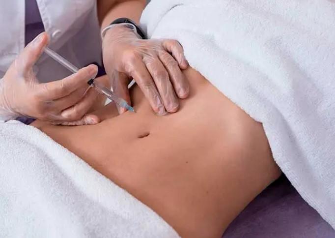 Mesoterapia